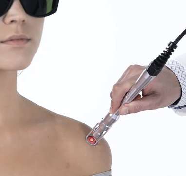 HILT terapija - High Intensity Laser Therapy